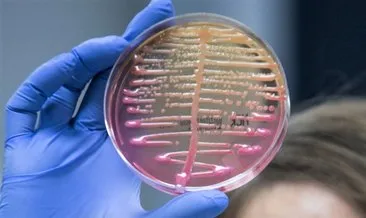 “Klebsiella pneumoniae” bakterisi antibiyotiklere karşı direnç kazanacak