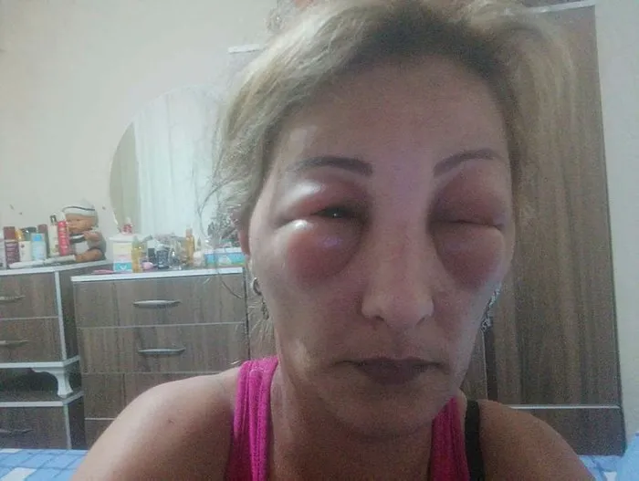 Saclarini Yaptirmak Icin Kuafore Gitti Canindan Oluyordu Sayfa 3 En Son Haber