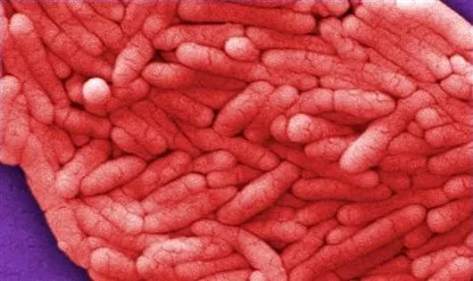 Ölümcül salmonella bakterisi yiyeceklerinize bulaşmış olabilir