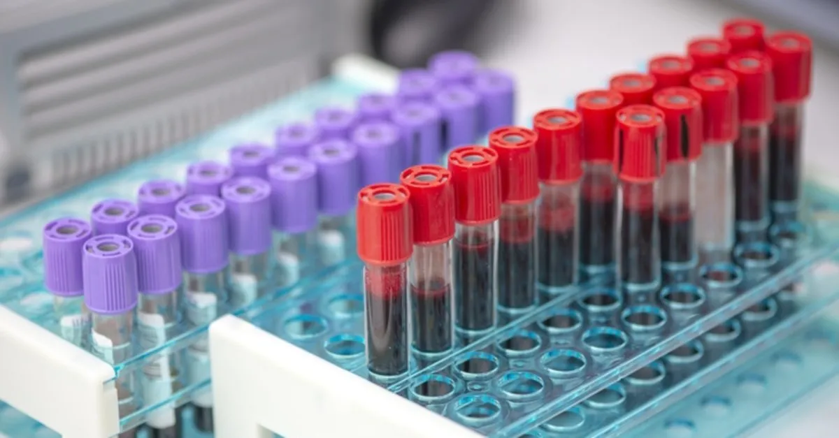 hgb nedir kan tahlilinde hgb dusuklugu ve yuksekligi ne anlama geliyor kanda hemoglobin olcumu saglik haberleri