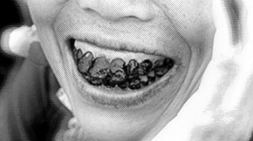 Bir tuhaf gelenek: Güzelleşmek uğruna dişlerini siyaha boyuyorlar! Özellikle evli kadınlar…