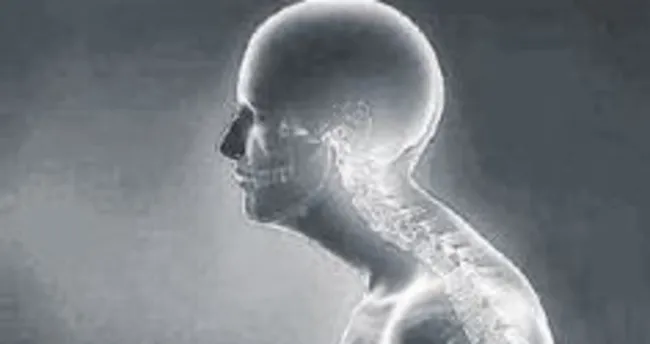 Omurgadaki duruş bozuklukları için pilates