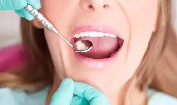 Yirmilik diş hakkında bilmeniz gerekenler!