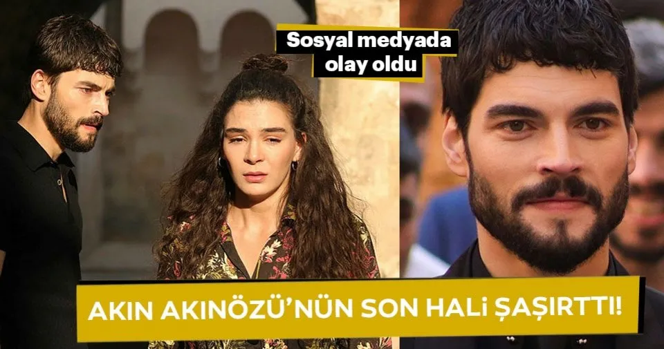 Akın Akınözü�nün son hali şaşırttı! Son Dakika Magazin Haberleri