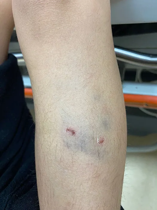 Okulda köpek saldırısı: 9 yaşındaki öğrenciyi ısırdılar! Müdür yardımcısının sözleri şaşırttı!