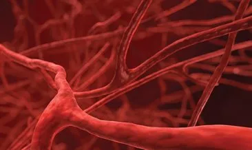 Aort damarı yırtılması nedir, belirtileri nelerdir? Aort damarı yırtılması tedavisi hakkında bilinmesi gerekenler!