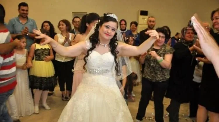 Down sendromlu kızı için damatsız düğün yaptı!