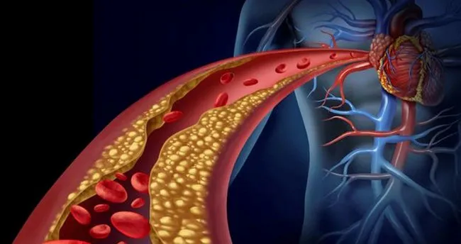 Kolesterol Nedir Belirtileri Nelerdir Kolesterol Nasil Dusurulur Ne Iyi Gelir Iste Detaylar Saglik Haberleri