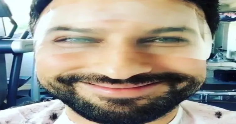 Megastar Tarkan Estetik Yaptirdi Fotohaber Magazin
