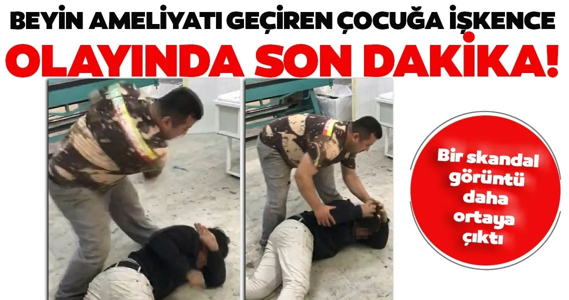 Beyin Ameliyati Geciren Cocuga Iskence Olayinda Son Dakika Gelismesi Son Dakika Haberler