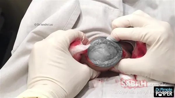 Doktora bu halde geldi! Sonrasındaysa...