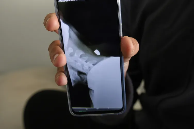 Yorgun mermi molada yakaladı: Şah damarına tam 2 santim!