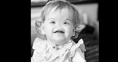 Dünyaya burunsuz geldi! Koku bile alamıyor: Engeli yaşam sevincini bitiremedi: Adeta ışık saçıyor