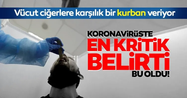 SON DAKİKA... Koronavirüs belirtileri arasında en kritik olanı açıklandı! Vücut ciğerleri korumak amacıyla kurban veriyor...