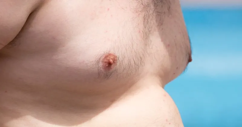 jinekomasti erkekte meme buyumesi