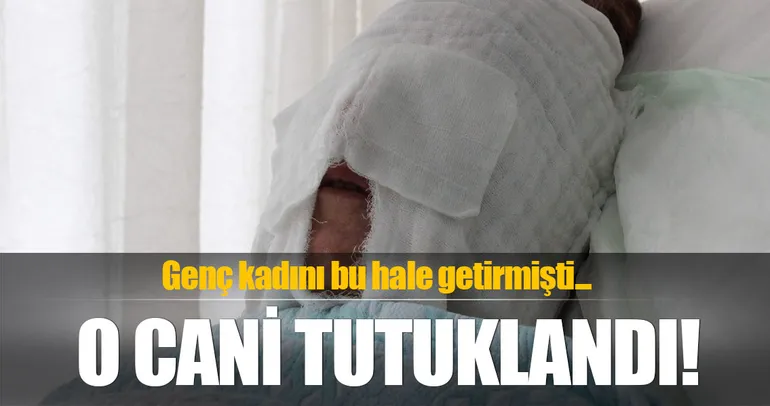 O cani tutuklandı