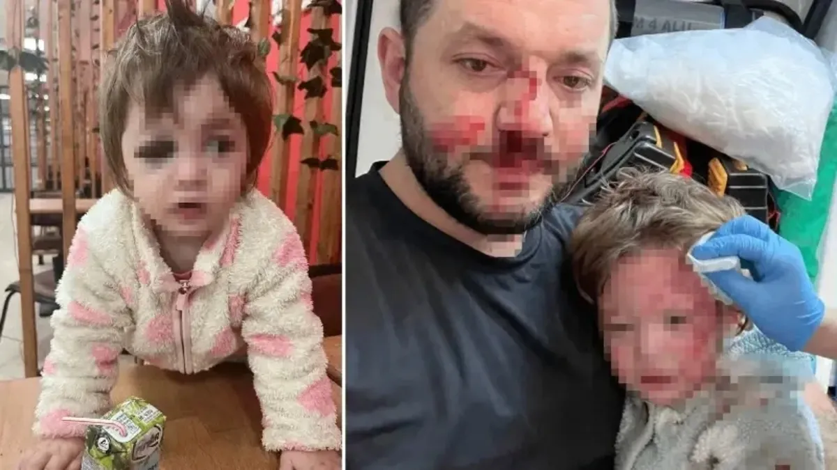 Yalova’da baba ile kucağındaki 14 aylık kızı komşuları tarafından darbedildi – Galeri Yalova’da baba ile kucağındaki 14 aylık kızı komşuları tarafından darbedildi – Galeri