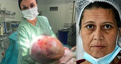 Kadın hastanın karnından çıktı: Doktorlar bile gözlerine inanamadı!