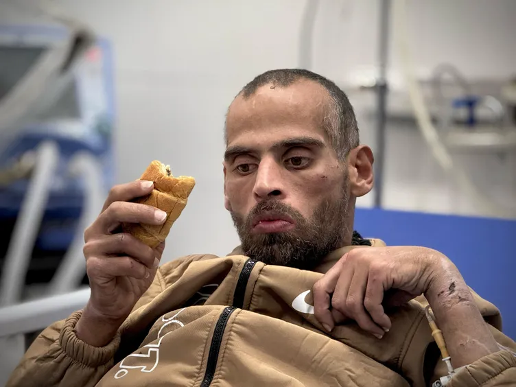 Katil İsrail’in yaptığı zulüm kan dondurdu! Siyonist işkence sonrası konuşmayı unuttu