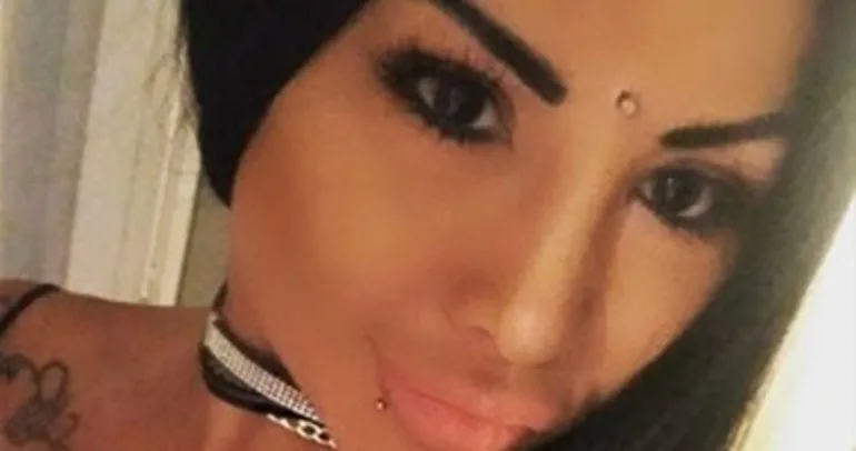 Goz Rengini Degistirmek Isterken Kor Oldu Galeri Dunya Goz Rengini Degistirmek Isterken Kor Oldu Galeri Dunya