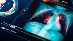 Elektronik sigara kullanımındaki korkunç tablo! Uzmanı uyardı: 5 yaşındaki çocuğun elinde gördüm