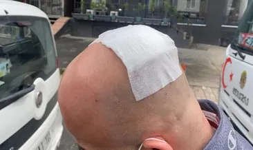 SON DAKİKA: İstanbul’da taksici dehşeti! Beyzbol sopası ile kafasını yardı!