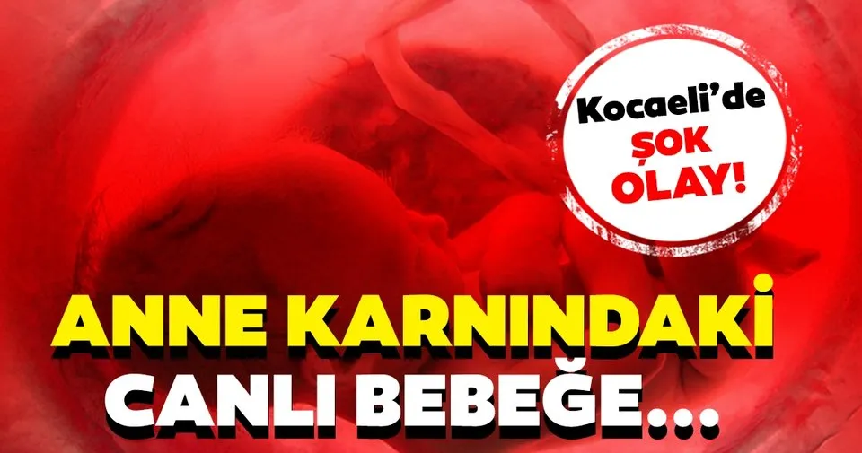 Son Dakika Kocaeli De Sok Olay Anne Karnindaki Canli Bebege Sabah