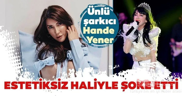 Hande Yener’in estetiksiz hali şoke etti! İşte Hande Yener ve diğer ünlü isimlerin estetiksiz halleri…