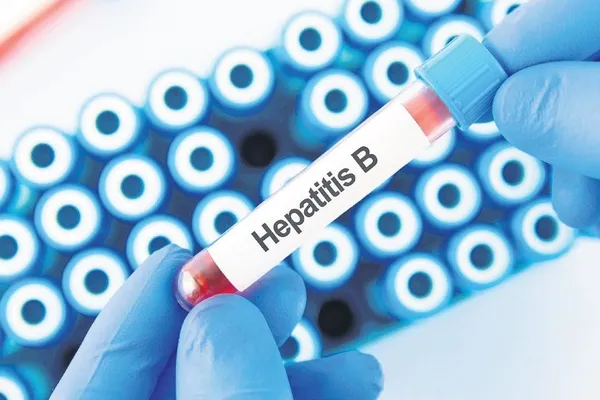 287-milyon-kisi-hepatitin-pencesinde-1785253570641.jpeg