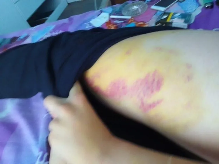 Balıkesir'de korku çiftliği!  'Ejder Salih' ve çeteci parmaklarını kesip işe göndermiş... 18 yaşındaki kız en ince detayına kadar anlattı