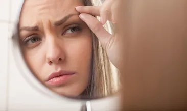 Kaş dökülmesi yüz ifadesini etkiliyor!