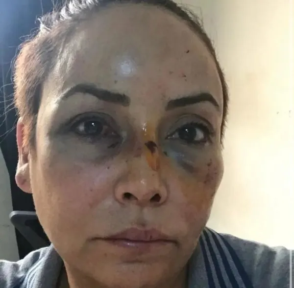 8-yilda-annelik-hakkim-elimden-alindi-1647876390843.jpeg