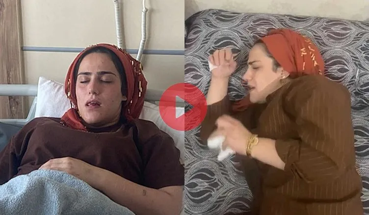 Hapşırma nöbeti kabusu oldu: 12 gündür ne yemek yiyebiliyor ne uyuyabiliyor!