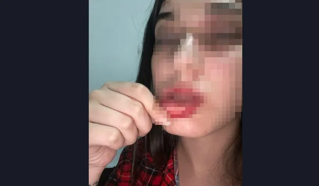 son-dakika-erkek-arkadas-dehseti-konusacagiz-diye-cagirip-darbetti-zavalli-kiz-son-halim-diye-paylasti-1764070191542.jpg (1721×1009)