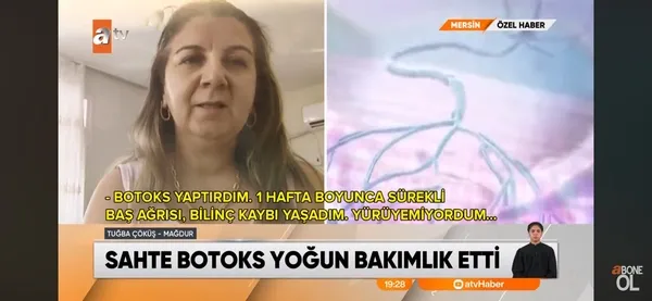 mersinde-sahte-botoks-kabusu-guzellik-ugruna-yogun-bakimlik-oldular-gunlerce-bilinc-kaybi-yasadim-1790839312419.jpeg