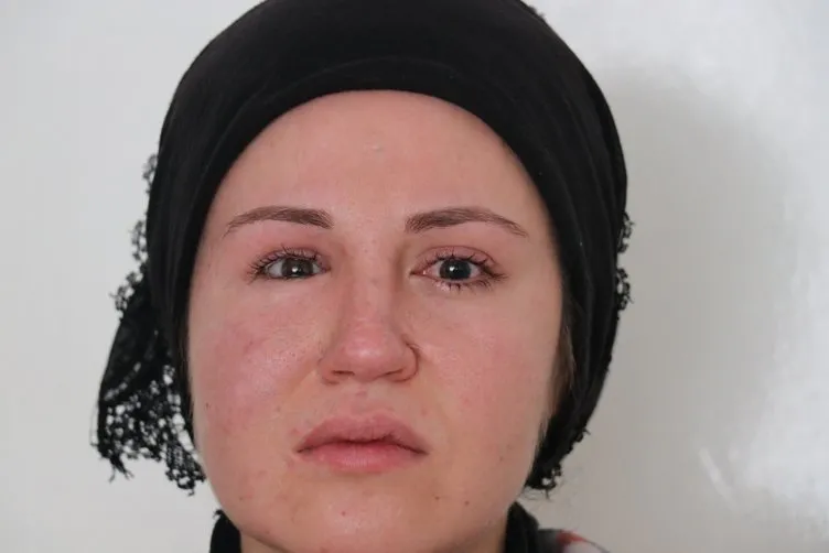 Son dakika: Gaziantep’te tüyler ürperten olay! Eşini başından vurdu, genç kadın gözlerini kaybetti...