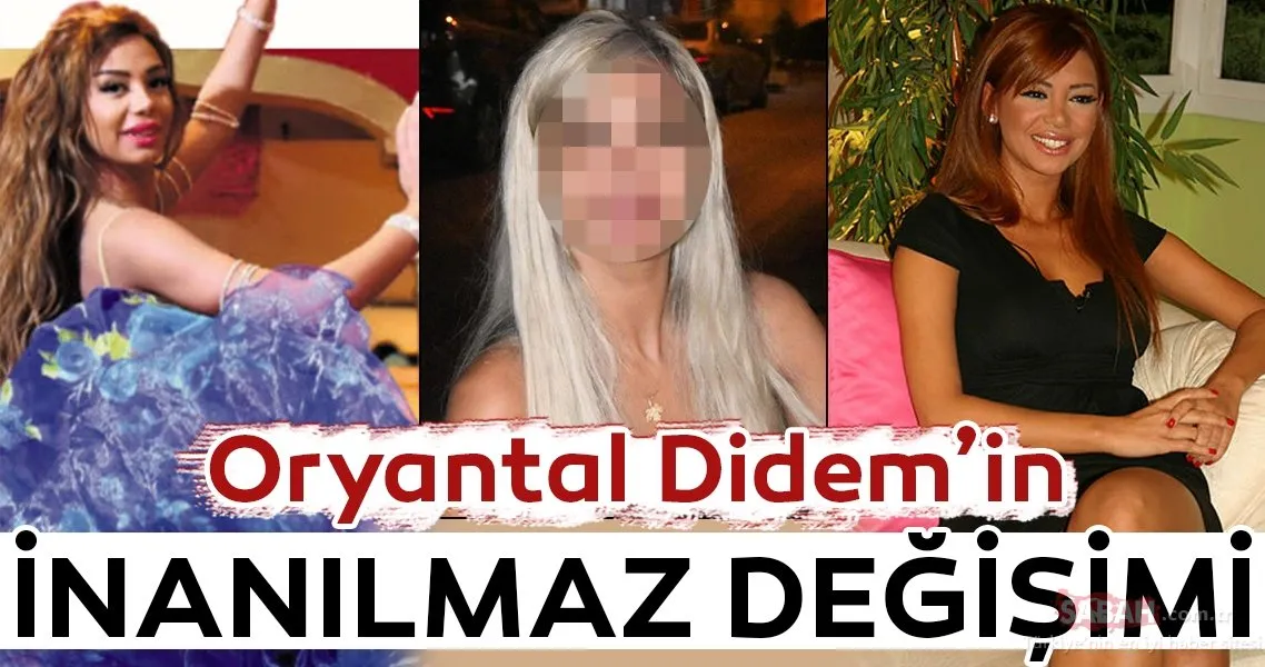 Didem Kınalı�nın son hali şaşırttı! İşte Didem Kınalı�nın şoke eden