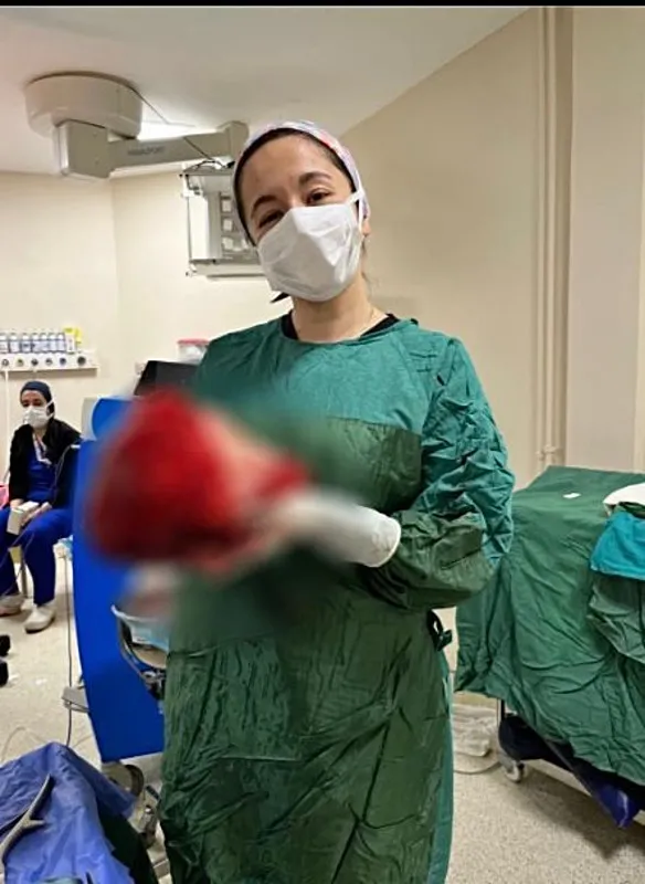 sivasta-saskinlik-yaratan-olay-gogsunden-7-kilo-750-gramlik-tumor-cikarildi-1778597698349.jpeg