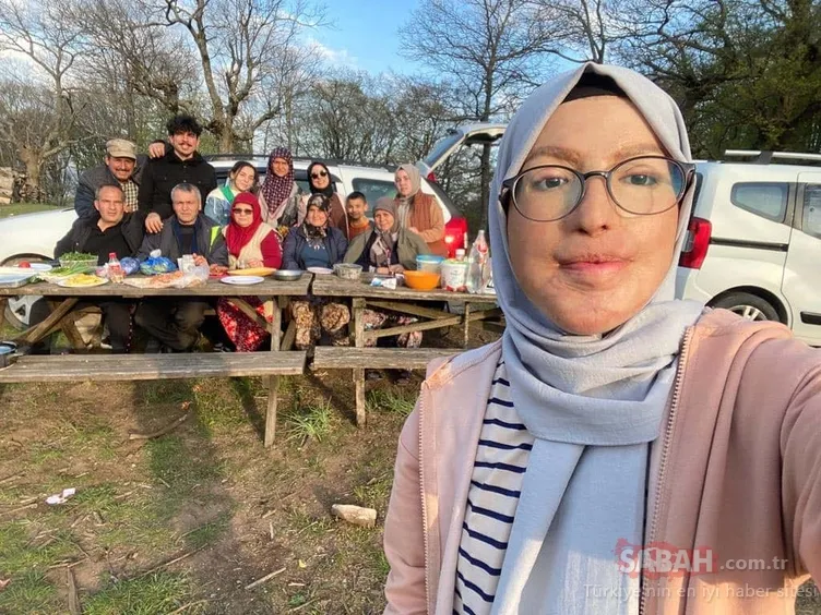 20 yıllık zorlu mücadele ve mutlu son: 49 ameliyatla yeni yüz