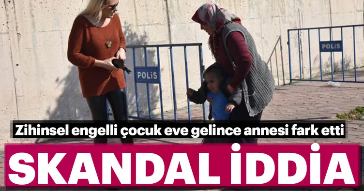 Antalya’da zihinsel engelli gence şiddet