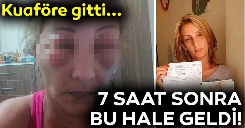 Saclarini Yaptirmak Icin Kuafore Gitti Canindan Oluyordu Sayfa 3 En Son Haber