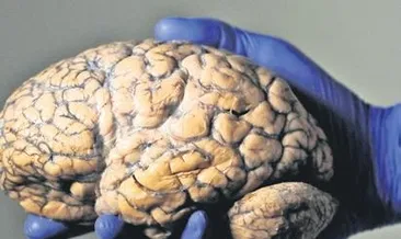 Beyni korumanın 6 yolu