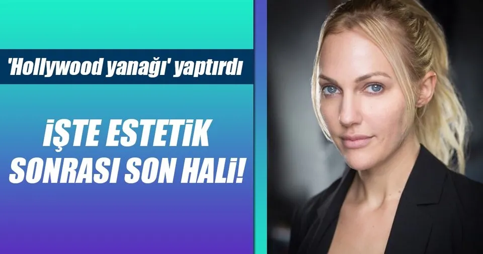 meryem uzerli yine estetik yaptirdi son dakika magazin haberleri