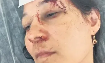SON DAKİKA | Yazlıkçı aileye aidat dayağı! Tatile geldiler, kâbusu yaşadılar: Demir sopalarla dövülüp hastanelik oldular #yalova