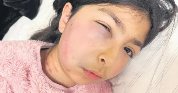 Türk kızı Ayşegül’e Alman zulmü