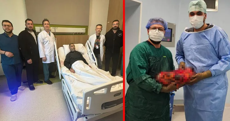 Yıllarca bu yükle yaşamış! Gaziantep’teki operasyonda karnından çıkanın ağırlığı 8 kilo: Kuş gibiyim