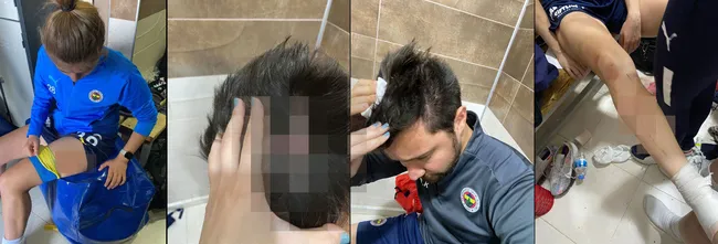 son-dakika-kadin-super-liginde-olayli-mac-amedli-oyuncular-fenerbahceli-oyunculara-saldirdi-1648902956869.jpg