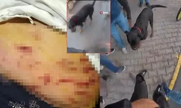 SON DAKİKA… Rottweiler cinsi köpek dehşet saçtı! Kabus dolu anlar kamerada: Bacaklarından ve karnından… #mersin