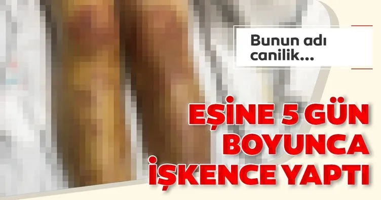 Eşine 5 gün boyunca işkence yaptı