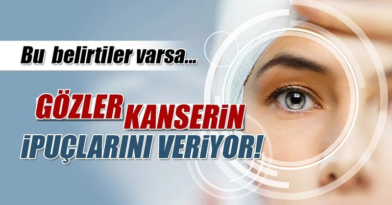 gozler kanserin ipuclarini veriyor kadin haberleri